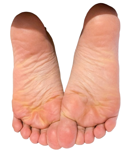 common foot injuries for runners